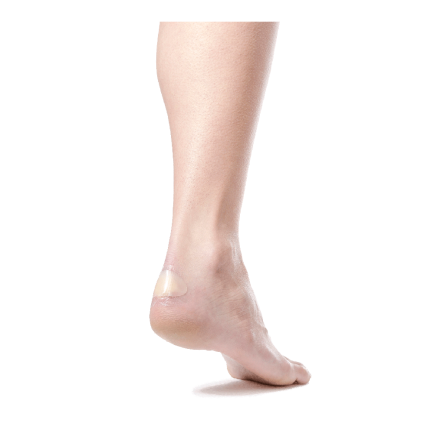 DoTobell Obliž za žulje 49P 3x